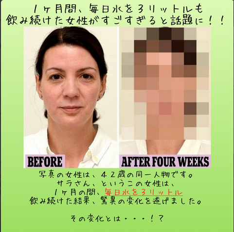 toganandes's tweet photo. 【毎日水を３リットル飲み続けた女性が…！？】

１ヶ月間、毎日水を３リットル飲み続けた女性の変化がすごすぎる！
とネットで話題にｗｗ

思わず目を疑ってしまう驚きの変化は
こちら⇒http://t.co/pTUhi1oll3

・ http://t.co/d5kkAtCniO