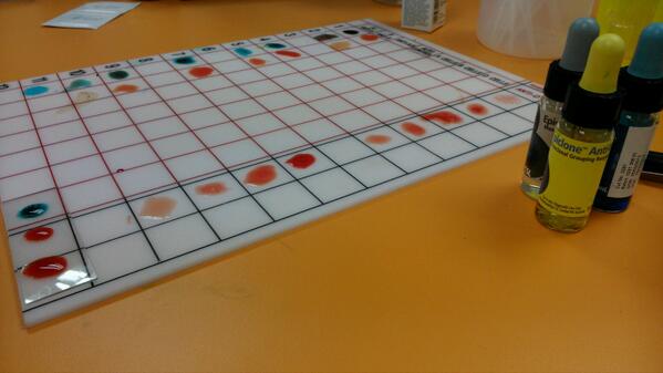 sitisaraaziz's tweet image. I'm a universal donor :) #bloodgrouptest