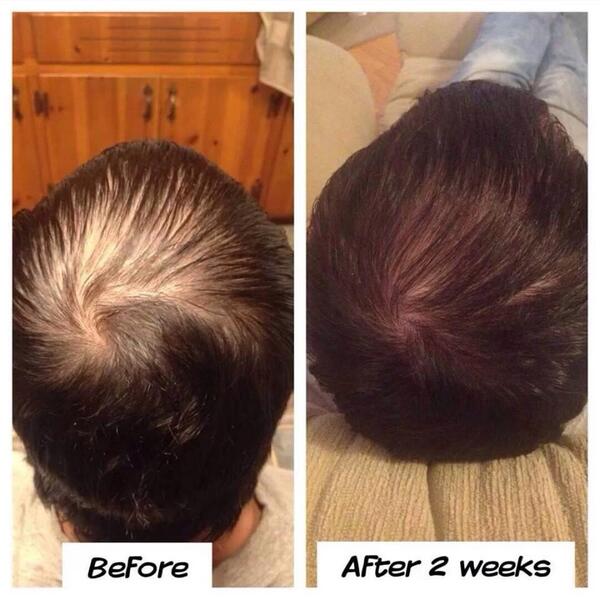 PurvanaMax's tweet image. Look at how powerful Purvana Max is!  The proof is in the picture! #purvanamax #wellgenix