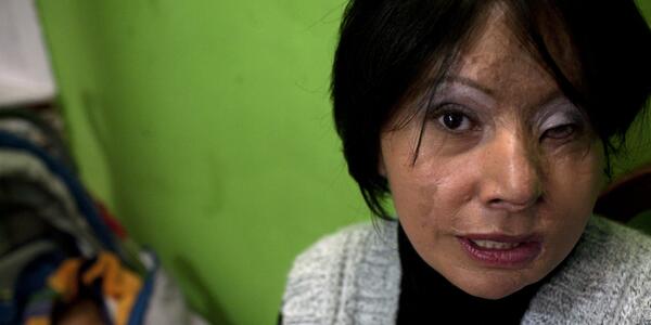 “<a href="/HuffPostCanada/">HuffPost Canada</a>: In Colombia, acid attacks are on the rise huff.to/1kHEY1K ” oh good .....