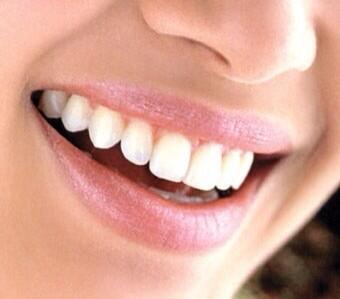 Dentalskills's tweet photo. We starten 16 mei a.s weer met de (klassikale) cursus Preventieassistent! https://t.co/JF4YC24n5q http://t.co/JPDGaZ53qO
