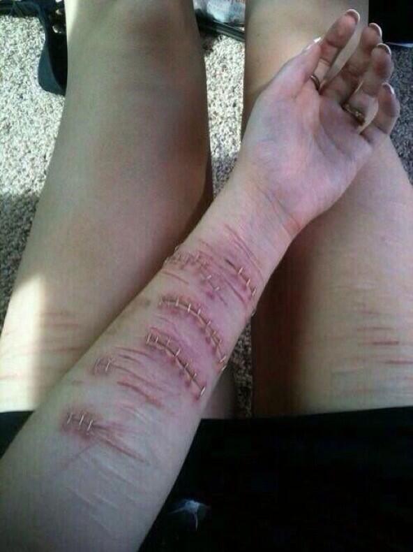 LiveHealthTips's tweet image. Actually starting to see some arm muscle definition! 😋😍 #Progress #fitfam #girlswholift #iifym #vegan