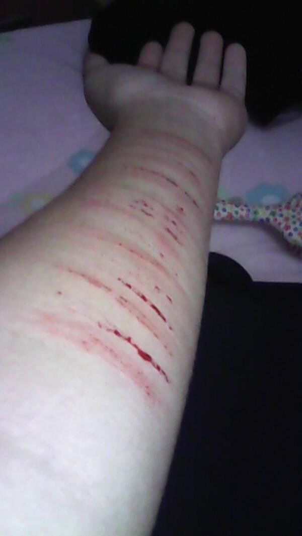 mutilated_'s tweet image. ):