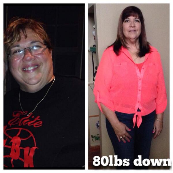 InShapeMDKansas's tweet photo. Wow! One of our great customers is down 80lbs since November. Look for her in our newest commercial! #inshapemd http://t.co/1tJTLoevnJ