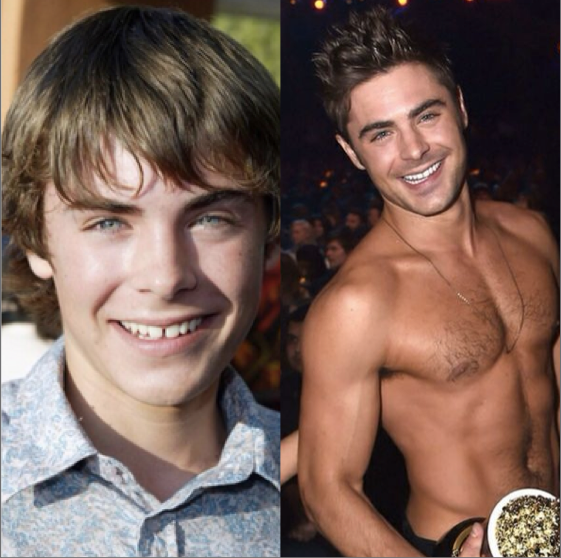 yourboycrush's tweet photo. Puberty did Zac Efron well http://t.co/IYCLs7vpsq