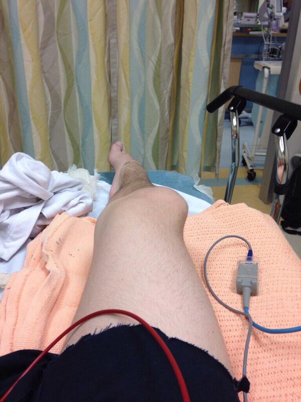 injurypics's tweet photo. Check out this dislocation :-) http://t.co/Yc8sW8pbO9
