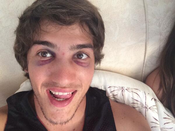 dcatrakilis's tweet photo. Feels great to get a win at Newlands yesterday! Wish my nose felt as good:) http://t.co/cB4u6fZ1Wp