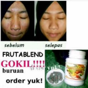 Ratu_HWI's tweet photo. Ajibs Jerawat HILANG permanen hnya dlm 7 HR,BPOM,kand:22 mcm buah+sayuran.add pin: 273BBB79 @apaajaIKLAN @JatengIKLAN http://t.co/HlXAzw6u8N