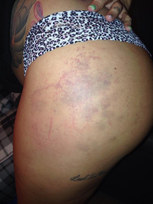 Effie Daniels put a beat down on me... Spank spank http://t.co/GrxkVFe6qR<a href="/tag/relaxitsjustsex"class="tags"><span>#relaxitsjustsex</span></a><a href="/tag/spreadlovenotlegs"class="tags"><span>#spreadlovenotlegs</span></a>