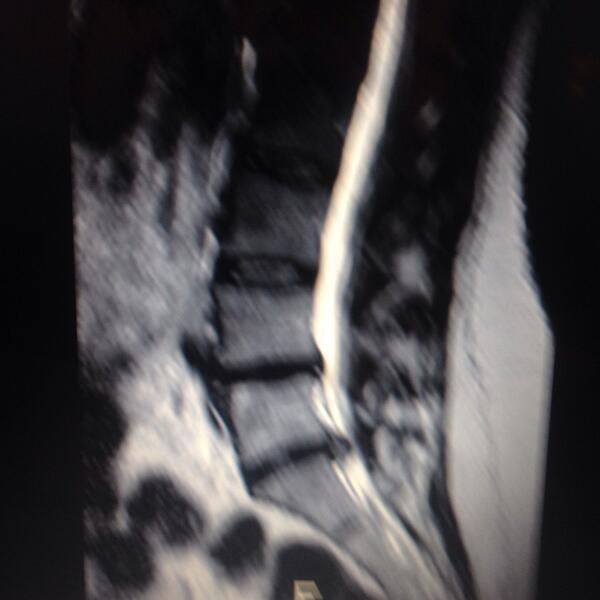 granellispinal tweet picture