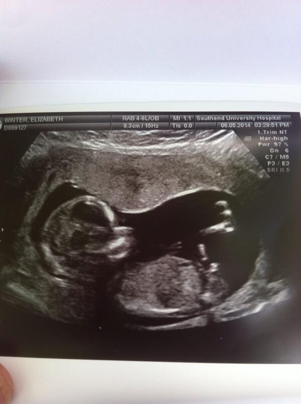 georgesloan6's tweet photo. Please be a boy !!! I need a little sidekick in my life !!!!!! #gonnabeananimal http://t.co/JooGS0KP59
