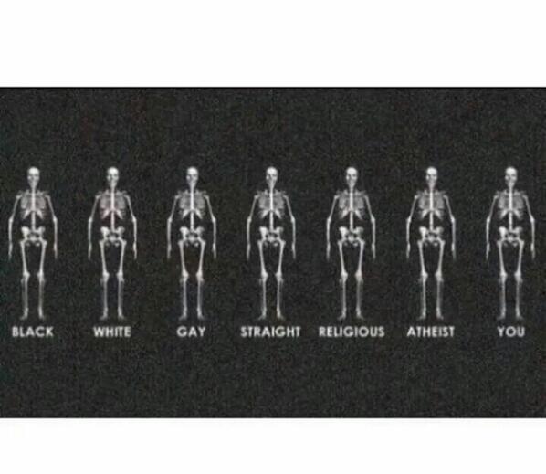 Ali_morad123's tweet photo. we all are beautiful and equal, no matter who u are and how much you have in ur bank account #same #equal http://t.co/NbsYlaLdAR