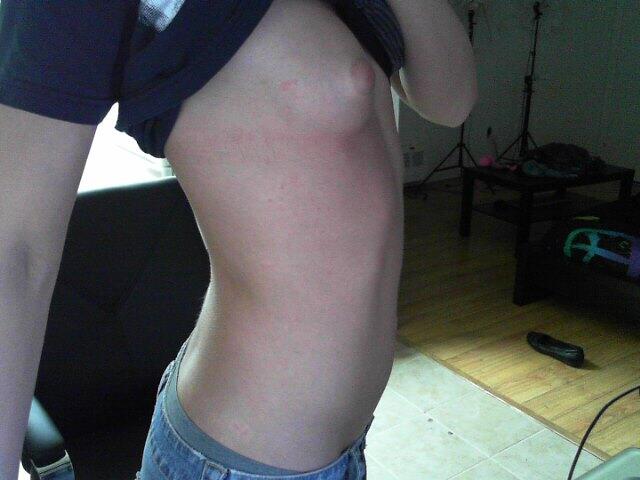 just when i got my hopes up. i honestly thought my psoriasis was cleared up. tired of this heartbreak
