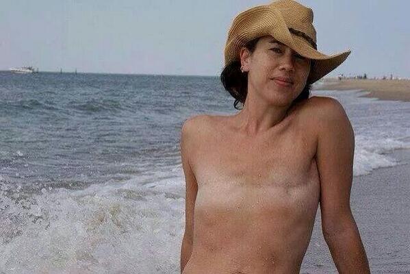 chamelaiontas's tweet photo. Breast cancer patient!!! Respect to this lady!!! http://t.co/rTmVgPf66I