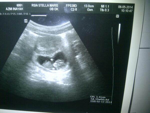 Azmiinayahulfi's tweet photo. :* http://t.co/O2otY9FhyN