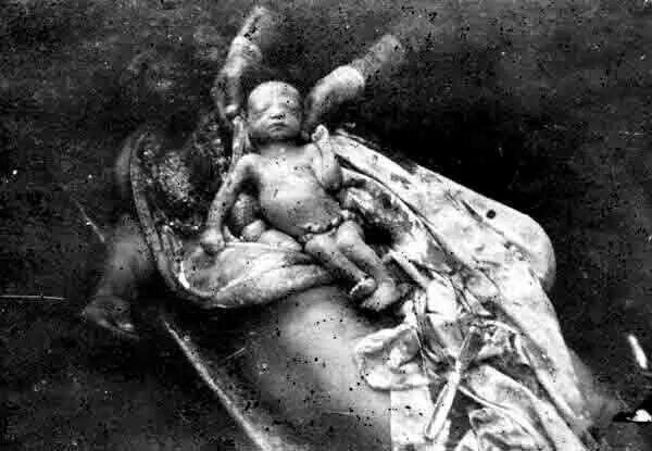 #soykırım Azerbaycan'da bir annenin karnindaydi !!!!
 #soykırımYalandır
 TarihinEnBüyükYalanı ErmeniSoykırımı