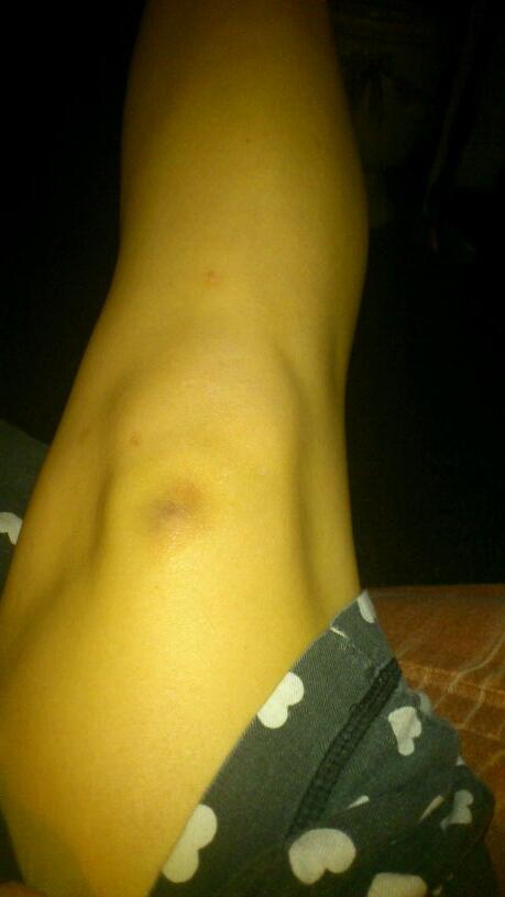 M_navarro9's tweet photo. Y si, mi cuerpo es lugar perfecto para albergar los picos de las mesas! \o/ http://t.co/N6sNfRMFtN