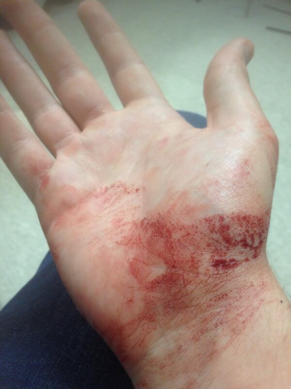 RickBeales's tweet photo. Shit got crazy tonight #turnup http://t.co/RBm5vBto9S