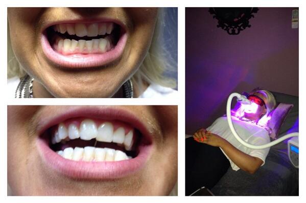 DesirableFeel's tweet image. Upper picture before below picture after a 20 minute sitting and side during the process book in today 07920112398