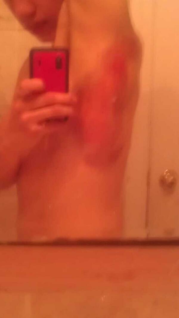 kri_kri9's tweet image. This hurt so much!!! I cried in the shower..... #trackprobz