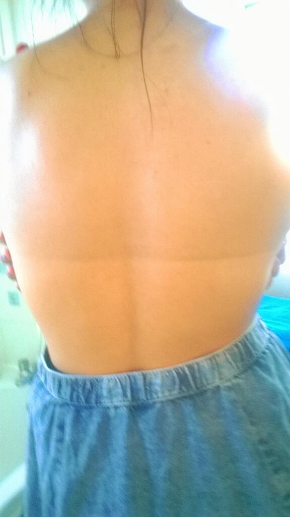 chenzaa_'s tweet photo. For all those with lost hope in the English weather... Heres my tan line from last week. #youcandoit #commonsummer http://t.co/qGNBBjpD8j