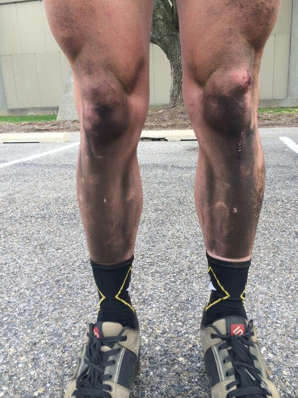 #little5