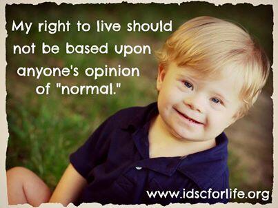annettemabel921's tweet photo. “@ProLifeFeminist: Abortion is discrimination against the disabled. #prolife #prochoice #EndAbortion http://t.co/D7nPEfCVfw”