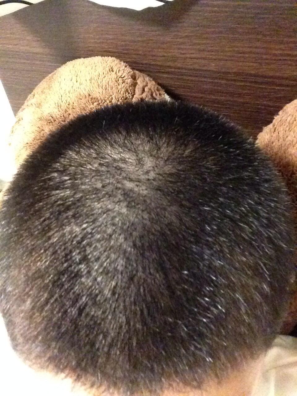 坊主日記 響 坊主2日目 10時から12時の間に髪が1番伸びるらしい そろそろ寝なければまずい 寝る 明日の髪の伸び具合に期待 Http T Co Numblvujoe 坊主日記 響 坊主2日目 10時から12時の間に髪が1番伸びるらしい そろそろ寝なければまずい 寝る 明日の髪の伸び具合に期待 Http T Co Numblvujoe