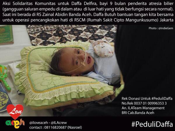 armandmaulana's tweet photo. RT @IndieGem: kang, mohon dibantu utk menyuarakan #peduliDaffa pasien atresia bilier, salam aceh kang. http://t.co/R4Fn6i7dZf