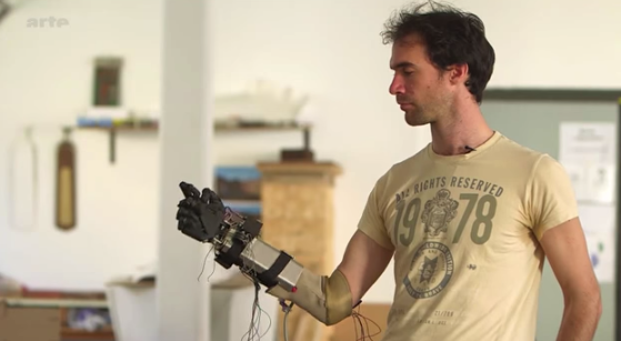 LeemFrance's tweet photo. Une prothèse bionique imprimée en 3D dans un Fablab http://t.co/gQk1VWOd5L via @FUTUREMAGfr cc @tousuniques http://t.co/qDVr3PecDU