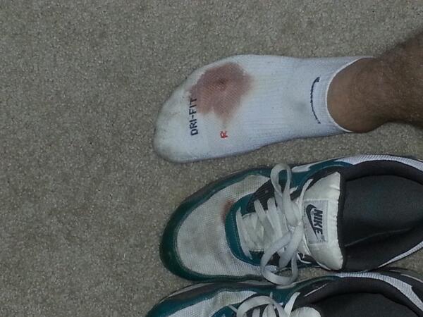 SwipeForAnswer's tweet photo. Curt Schilling and the bloody sox was a fluke. Did not have the same results on the mound sunday with this #bloodysox http://t.co/F2Pm9WDZHa
