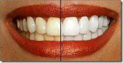 LaLeyFemenina's tweet photo. La verdadera manera de como blanquear los dientes
Ver👉 http://t.co/mdDxcXdoQa
Leer👉 http://t.co/U0pdQEJL5w

RT 👇👇 http://t.co/vD5vipH473