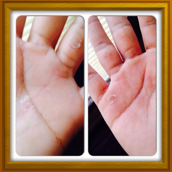 evillfairy's tweet image. Just kick Cindy's butt! #CrossFitProblems #ripfix #crossfitgirls #callus