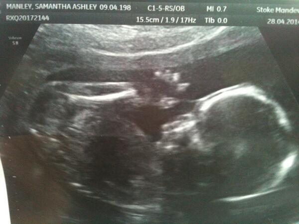 sambarina25's tweet photo. It's a boy,so happy :D @Doogle_Dog! http://t.co/8Wp8EejHgu