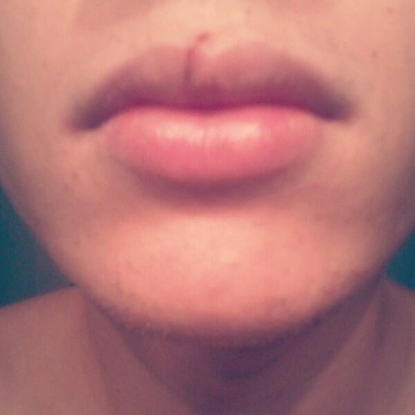 Federico_Ce's tweet photo. Me corte el labio :( http://t.co/0WxIJ1gw0X