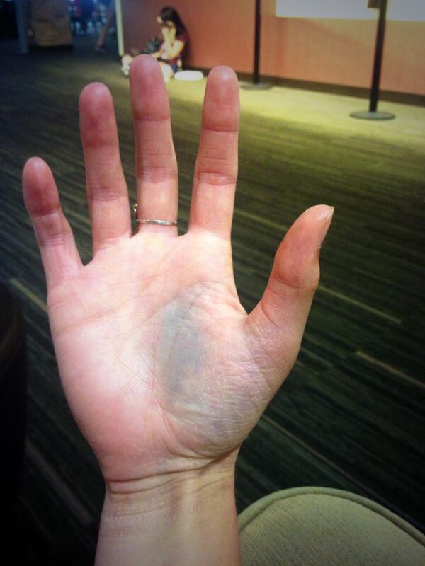 LadySamiBuggy's tweet image. Should I be disgusted or enthralled by the fact that three of my fav colors are now present on my hand?#Imenthralled