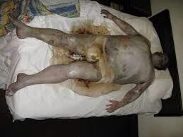 Hakedoffhafpint's tweet image. #botchedexecution Is he dead yet? Only in Oklahoma