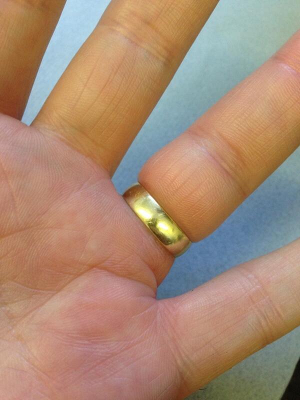 Too Fat For Ring Finger