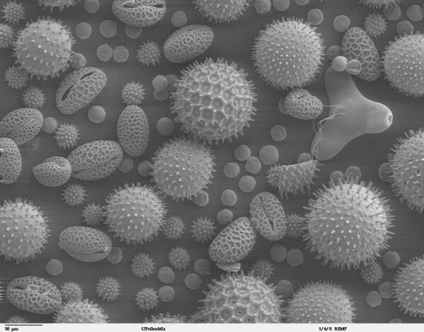 Kazuki Fujisawa 花粉症について調べてて見つけたんだが 花粉って本当に凶悪な姿してるね 花粉の電子顕微鏡写真 Http T Co Pvszf69leg Http T Co Ro1eazkfdz