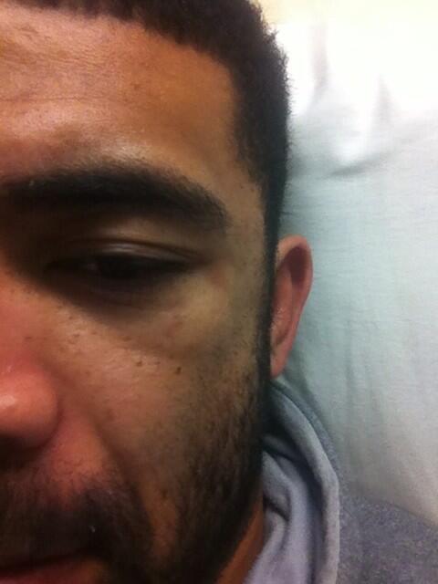 2A1_MMA's tweet photo. Gonna have a shiner in the morning!! #boxing #muaythai http://t.co/ETW4MPNCZN