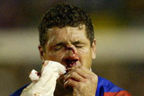 EasternRhinosRL tweet media