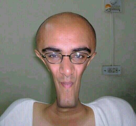 RadManKind's tweet image. ער האט זיך געבענד אויפן פנים- 
וויאזוי? 
מיט צווי פראסקעס