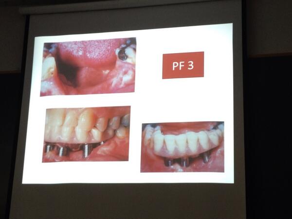 Javi Barbi (@javibarbi) on Twitter photo 