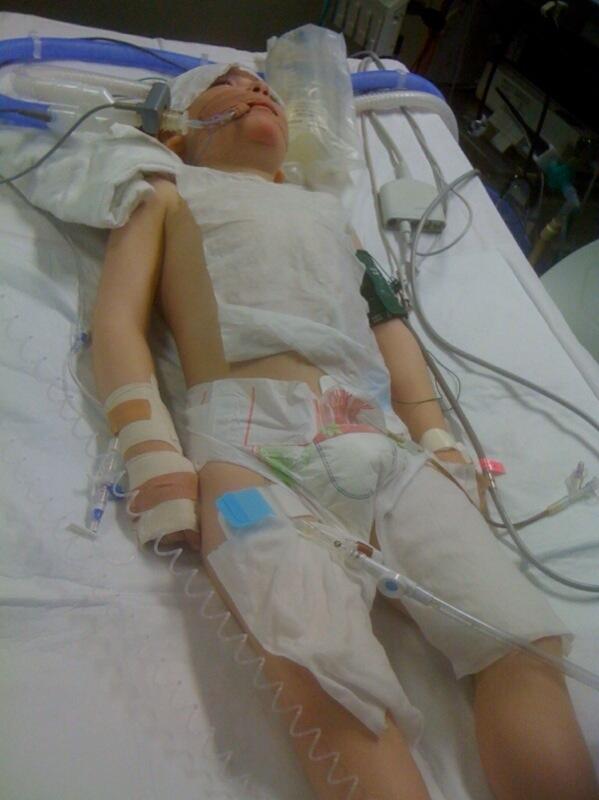 DeclanCoyleNow's tweet photo. Alexander after seizure. 9 days  intensive care. 24/7 care. 31 medications a day. HSE took away his medical card. http://t.co/kWYWc3KsNZ