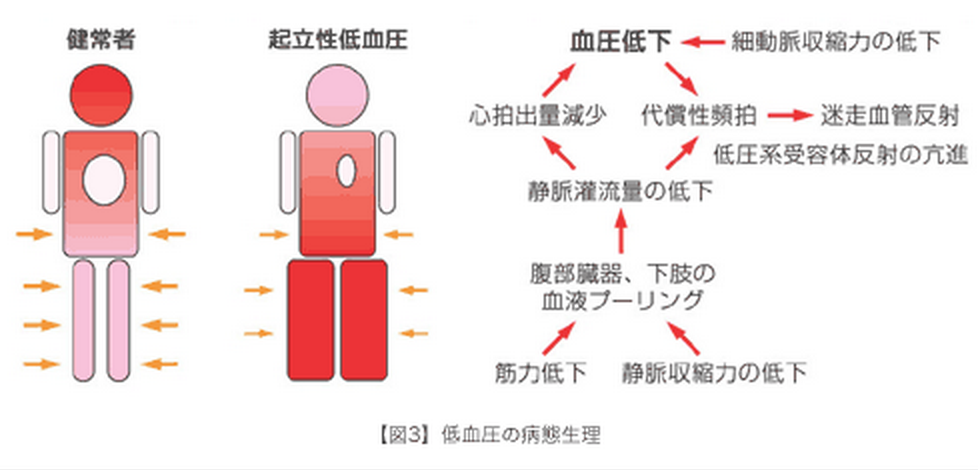 ゴロ 解剖生理イラスト على تويتر 起立性低血圧 Http T Co j2bwfb5z ゴロ 解剖生理イラスト على تويتر 起立性低血圧 Http T Co j2bwfb5z