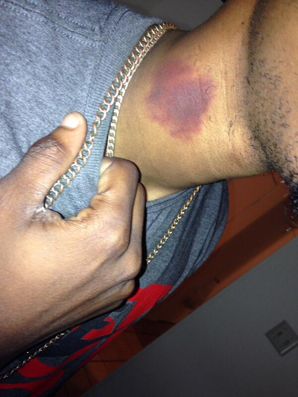 darryngq's tweet photo. Pray for the hommie.🙏 Idk how bro gone explain this to his girl. http://t.co/QIE4n6eGaE