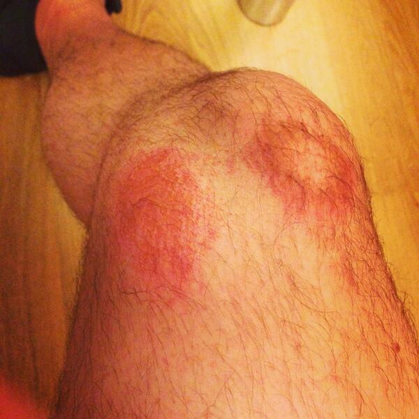 betty15thfc's tweet image. Love peeling this off the sheets in the morning #hardground #sudacrem