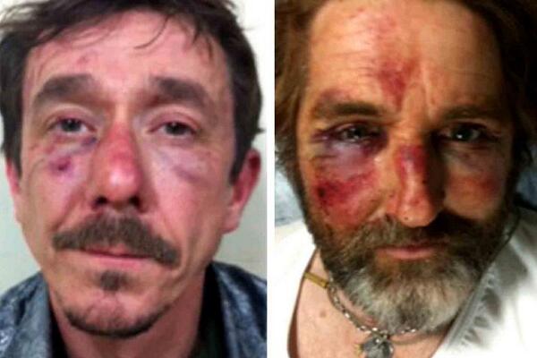 thetimes's tweet photo. Anthony Loyd tells the story of how he &amp; Jack Hill were kidnapped &amp; beaten in #Syria this week http://t.co/AjIBj5QHMW http://t.co/St9Zf62O6v