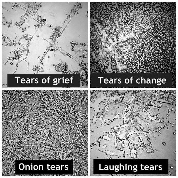 FISICALIMITE's tweet photo. Y así se ven tus lágrimas bajo un microscopio dependiendo de tu estado de ánimo http://t.co/Mki5Bvkd0e