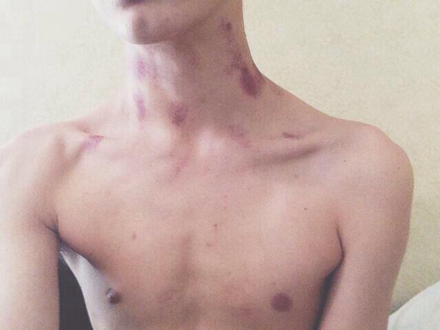 lovebites u on X